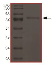 SDS-PAGE - Recombinant human Met (c-Met) (mutated D1228N) protein (AB185270)