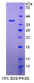 SDS-PAGE - Recombinant Human Met (c-Met) protein (His tag) (AB270599), expandable thumbnail