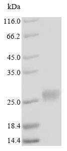SDS-PAGE - Recombinant Human Metallothionein-4 protein (Tagged) (AB235799)