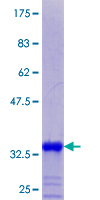 SDS-PAGE - Recombinant Human Metallothionein protein (GST tag N-Terminus) (AB112324)