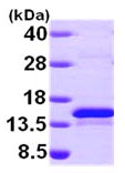 SDS-PAGE - Recombinant Human Methionine Sulfoxide Reductase B protein (AB99522)