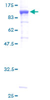 Recombinant Human Methylmalonyl Coenzyme A mutase protein
