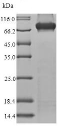 SDS-PAGE - Recombinant Human Methylmalonyl Coenzyme A mutase protein (His tag) (AB235808)