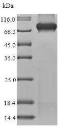 SDS-PAGE - Recombinant Human Methylmalonyl Coenzyme A mutase protein (His tag) (AB235808)