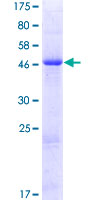 SDS-PAGE - Recombinant Human Methyltransferase like 5 protein (GST tag N-Terminus) (AB162213)