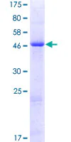 SDS-PAGE - Recombinant Human Methyltransferase like 5 protein (GST tag N-Terminus) (AB162213)
