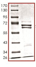 SDS-PAGE - Recombinant Human Metnase protein (AB125543)
