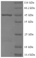 SDS-PAGE - Recombinant Human METRNL protein (His tag) (AB225666)