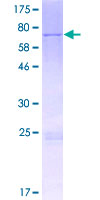 Recombinant Human METT11D1 protein
