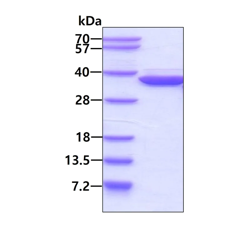 SDS-PAGE - Recombinant Human METTL1 protein (His tag N-Terminus) (AB103495)
