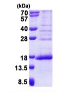 SDS-PAGE - Recombinant Human METTL21A protein (AB167907)