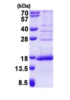 SDS-PAGE - Recombinant Human METTL21A protein (His tag N-Terminus) (AB167907)