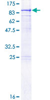 Recombinant Human METTL3 protein