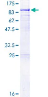 SDS-PAGE - Recombinant Human METTL3 protein (GST tag N-Terminus) (AB163377)