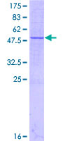 SDS-PAGE - Recombinant Human METTL7A protein (AB161809), expandable thumbnail
