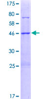 SDS-PAGE - Recombinant Human METTL7B protein (AB165837)