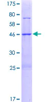 SDS-PAGE - Recombinant Human METTL7B protein (AB165837)