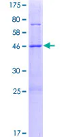 SDS-PAGE - Recombinant Human METTL7B protein (GST tag N-Terminus) (AB165837)