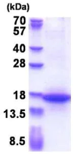 SDS-PAGE - Recombinant Human MFAP3 protein (His tag N-Terminus) (AB180325)