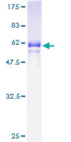 SDS-PAGE - Recombinant Human MFI2/MTf protein (AB158883)