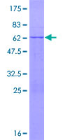 Recombinant Human MG53 protein