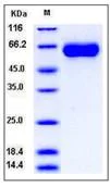 SDS-PAGE - Recombinant Human MGAT5 protein (His tag) (AB276387)