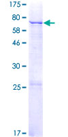 Recombinant Human MGAT5B protein