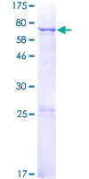 SDS-PAGE - Recombinant Human MGAT5B protein (GST tag N-Terminus) (AB165538)
