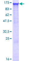 SDS-PAGE - Recombinant Human MGEA5/OGA protein (AB153117)