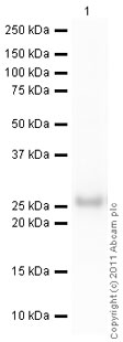Western blot - Recombinant Human MGMT protein (His tag N-Terminus) (AB79251)