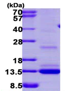 SDS-PAGE - Recombinant Human MGP protein (denatured) (AB113156)