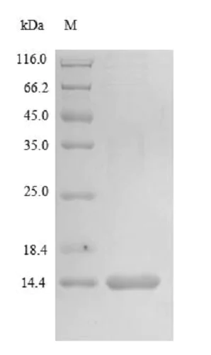 SDS-PAGE - Recombinant Human MGP protein (Tagged) (AB235811)