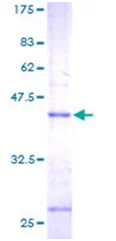 SDS-PAGE - Recombinant Human MGST1 protein (AB114792)