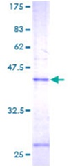 SDS-PAGE - Recombinant Human MGST1 protein (AB114792)