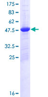 SDS-PAGE - Recombinant Human mH2A2 protein (AB131967)