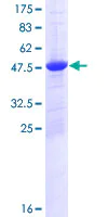 SDS-PAGE - Recombinant Human mH2A2 protein (GST tag N-Terminus) (AB131967)