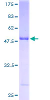 SDS-PAGE - Recombinant Human MHC Class II beta protein (Tagged) (AB114224)