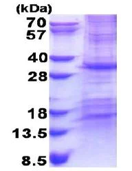SDS-PAGE - Recombinant Human MIC19 protein (His tag N-Terminus) (AB171478)