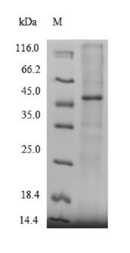 SDS-PAGE - Recombinant Human MICAL2 protein (His tag) (AB241260)