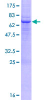Recombinant Human MICB protein