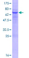 SDS-PAGE - Recombinant Human MICB protein (GST tag N-Terminus) (AB158894)