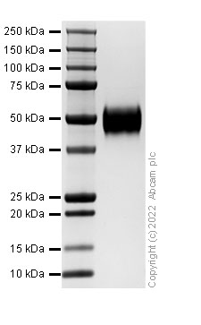 SDS-PAGE - Recombinant Human MICB Protein (His-tag) (Active) (AB307787), expandable thumbnail