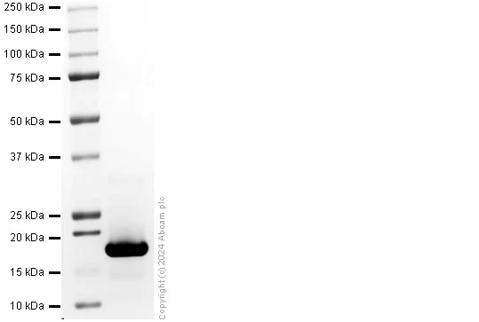 SDS-PAGE - Recombinant Human Midkine Protein (His tag) (AB318940)