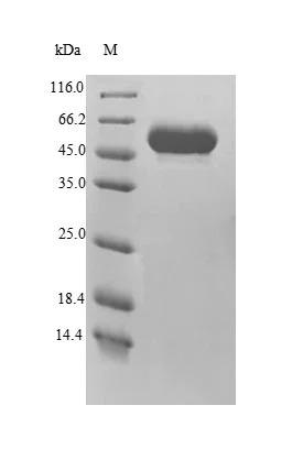 SDS-PAGE - Recombinant Human MINPP1 protein (His tag) (AB241455)