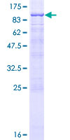 SDS-PAGE - Recombinant Human MIRO1 protein (AB163047), expandable thumbnail