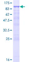 SDS-PAGE - Recombinant Human MIRO1 protein (GST tag N-Terminus) (AB163047)