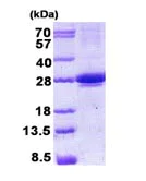 SDS-PAGE - Recombinant Human MIS12 protein (denatured) (AB139793)