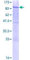 SDS-PAGE - Recombinant Human MiTF protein (AB158898), expandable thumbnail