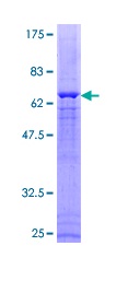 Recombinant Human MKP-1 protein