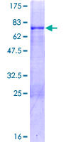 SDS-PAGE - Recombinant Human MKX protein (AB166113)